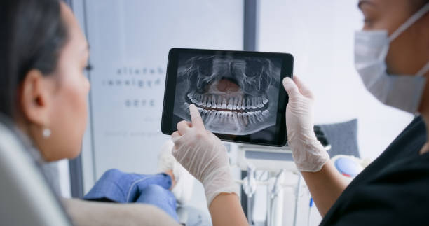 Licensed Tooth Extraction service in Billings, MT - Smile Center Dentistry